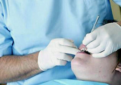 prevenzione-dentale-evitare-protesi